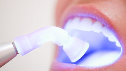 Dentística e Estética